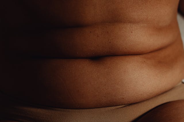Grăsimea abdominală – o amenințare silențioasă. Metode eficiente pentru a scăpa de ea