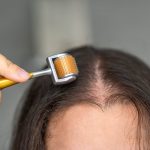 Minoxidil