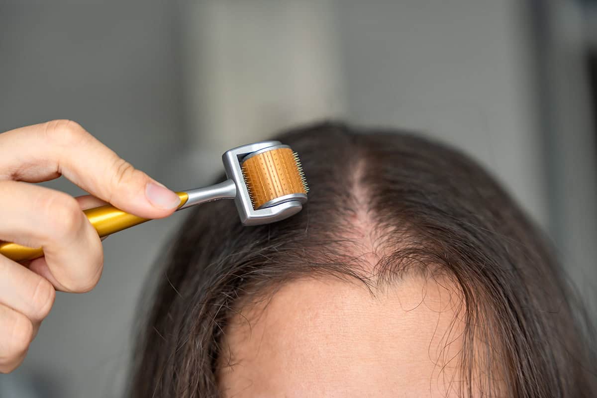 Minoxidil